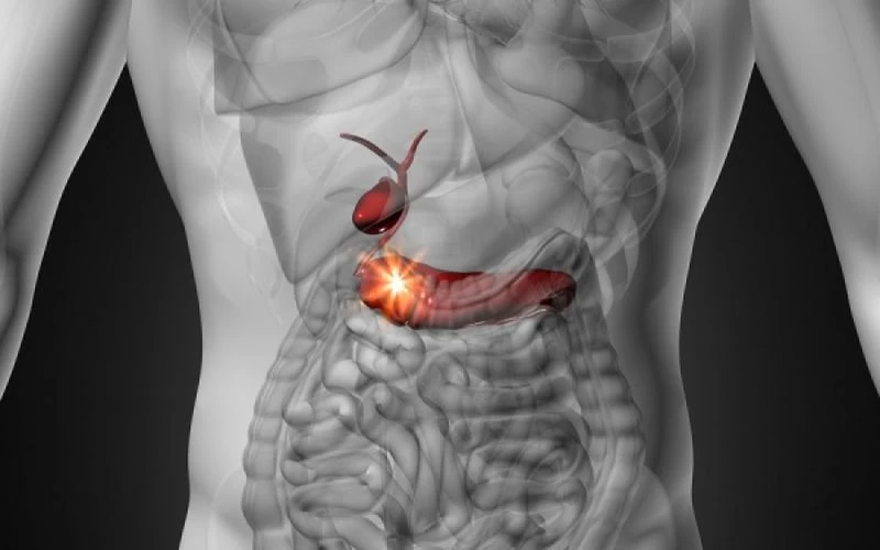 Καρκίνος του παγκρέατος: Τα αθώα σημάδια που οι περισσότεροι αγνοούν